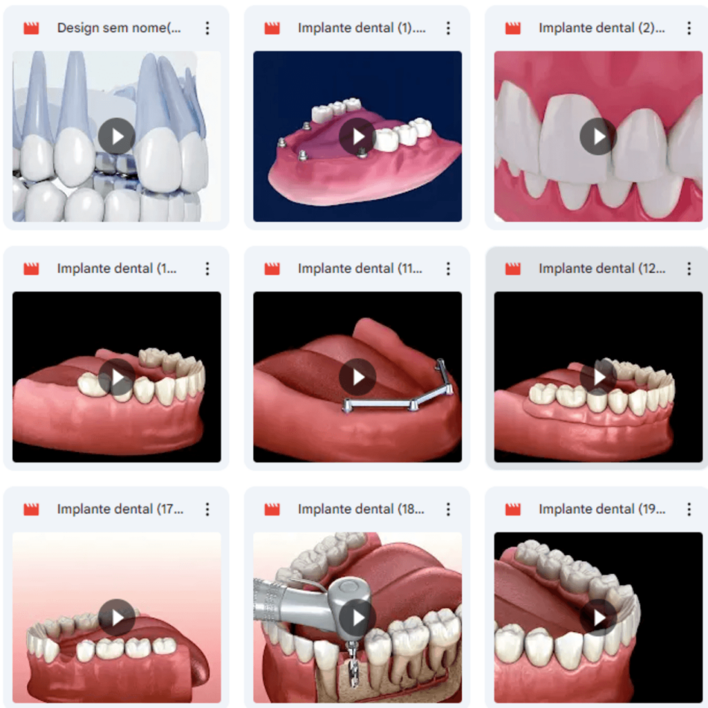 150+ Videos of Dental Procedures